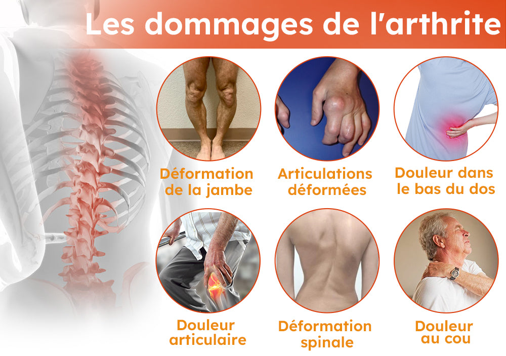 Furzero™ Crème Pour L'arthrite